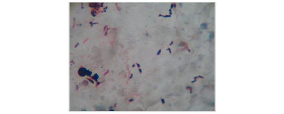 Gránulos de PHA en bacterias halófilas nativas teñidas con Sudan Negro B